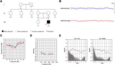 Identification of a novel AIFM1 variant from a Chinese family with auditory neuropathy